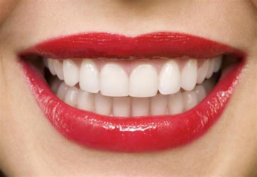 آیا انجام لمینت دندان محدودیت سنی دارد؟