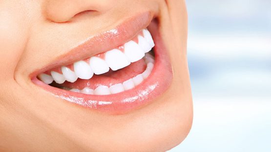 بلیچینگ دندان چند درجه دندان را روشن تر میکند؟
